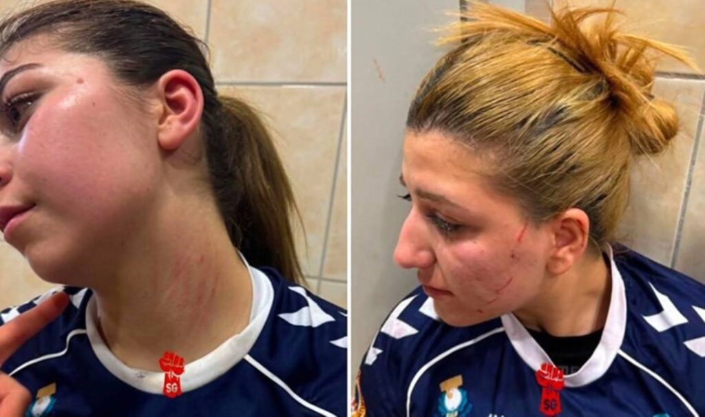 sporda da kadina siddet rakip takimin erkek taraftarlari galibiyet sevinci yasayan sanliurfa gunesin cocuklari yqqe7sM6