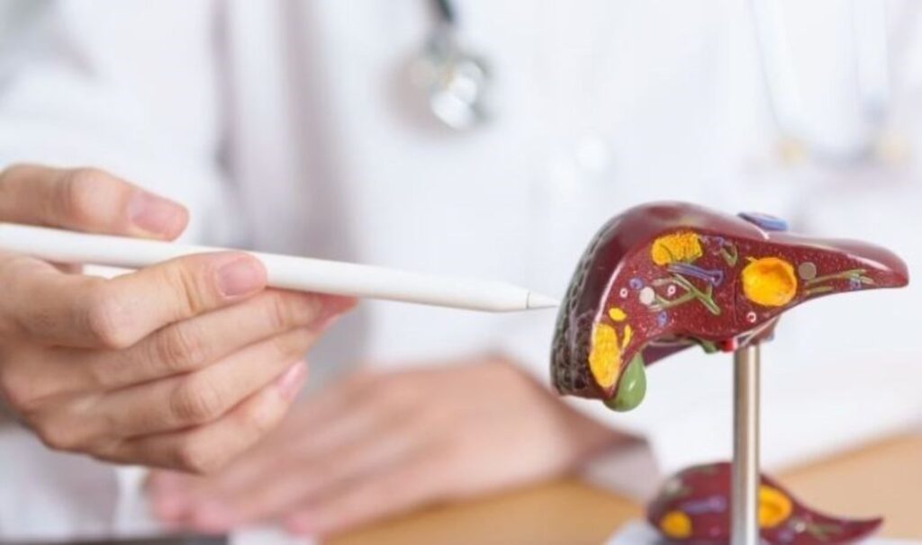Karaciğerin dostu mucize yöntem: Karaciğer yağlanmasına iyi gelen 7 doğal çözüm 7 karacigerin dostu mucize yontem karaciger yaglanmasina iyi gelen 7 dogal cozum jmKy1GSi