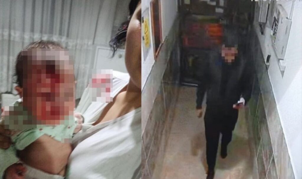 ankarada erkek siddeti 4 aylik bebegini cam sehpaya atip hastaneye gitmesine engel oldu jj7P38cP