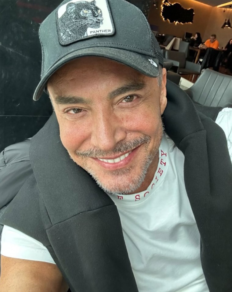 o halleri cok konusulmustu cenk eren neden estetik yaptirdigini acikladi 0