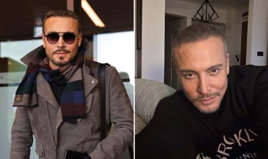 o halleri cok konusulmustu cenk eren neden estetik yaptirdigini acikladi spZls8qJ