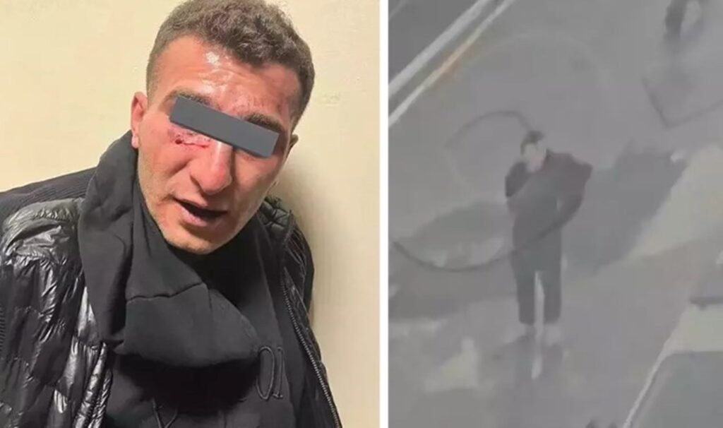 Bağcılar'da 2 polise bıçakla saldıran şahsın ifadesi ortaya çıktı: 'O an karar verdim' 2 bagcilarda 2 polise bicakla saldiran sahsin ifadesi ortaya cikti o an karar verdim qzSsjGuf
