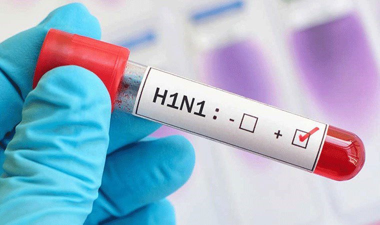 saglik calisaninin olumu endise yaratti domuz gribi h1n1 hizla yayiliyor domuz gribinin belirtileri nelerdir KU6ERNC7