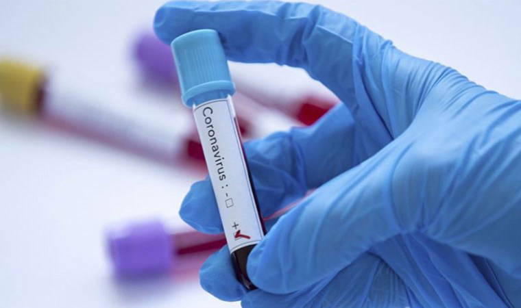 Çinli araştırmacılar, yeni tip koronavirüs keşfetti 1 cinli arastirmacilar yeni tip koronavirus kesfetti XwfgGAr5