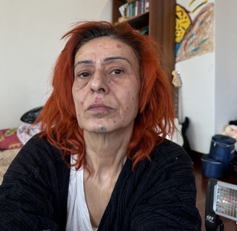 yuzu yanmisti yildiz tilbeden maskeli poz 1